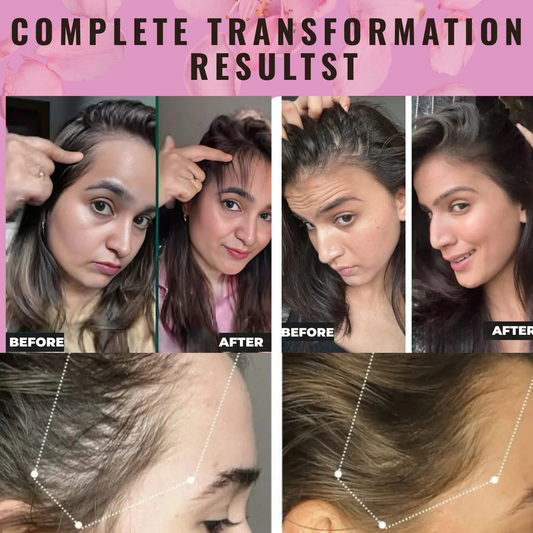 Hair Growth Support Comb – Red Light + scalp Massager